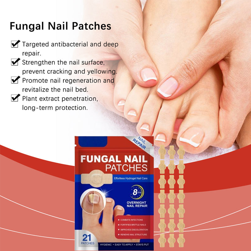 Sopp i neglene - hurtigvirkende, brukervennlig neglepleiebehandling