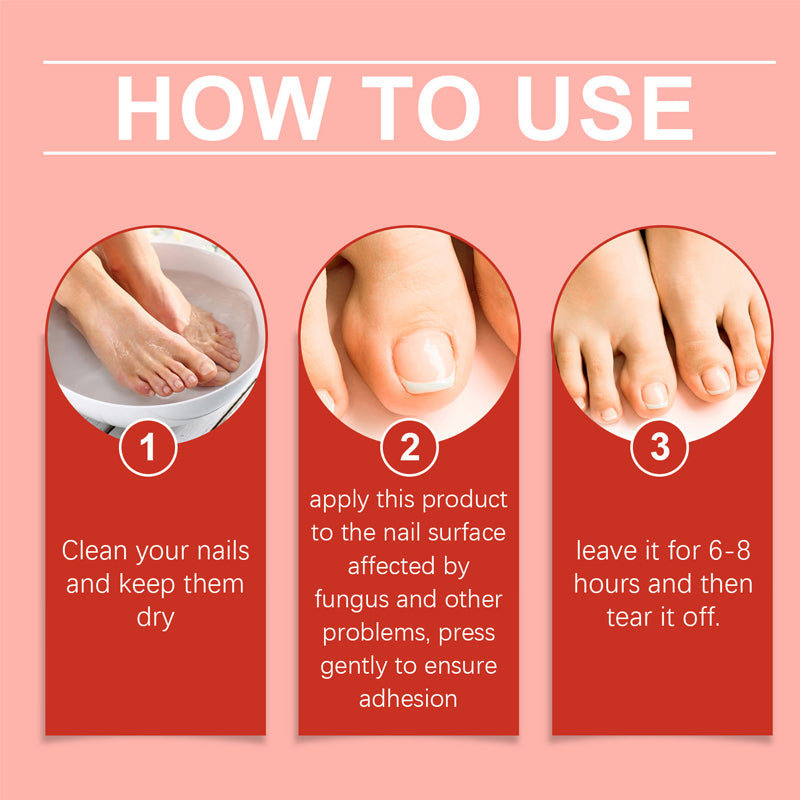 Sopp i neglene - hurtigvirkende, brukervennlig neglepleiebehandling