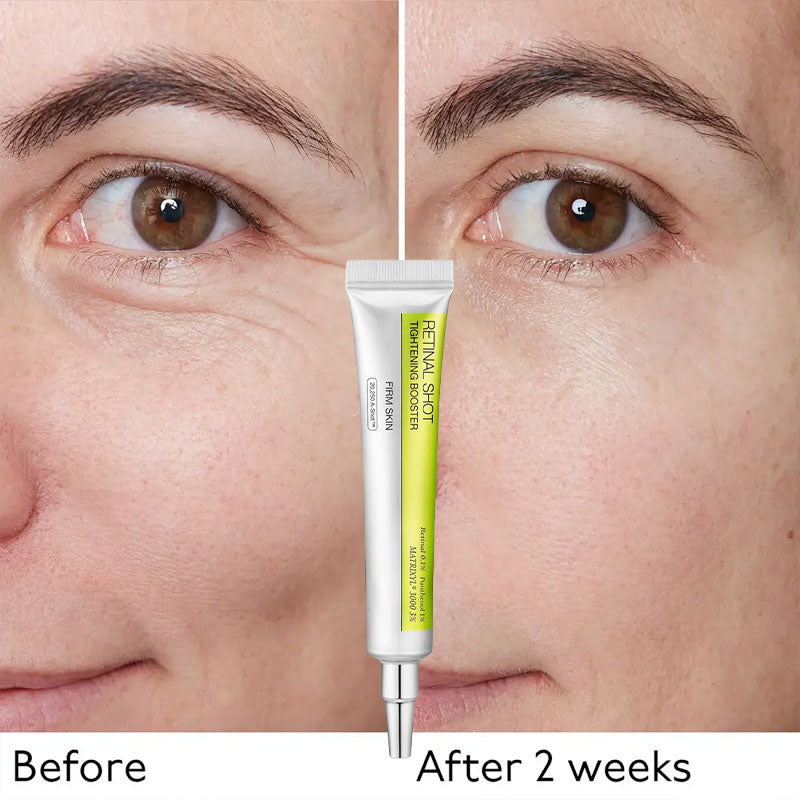 Retinol oppstrammende øyekrem