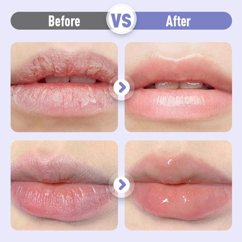 👑Fuktighetsgivende leppeserum som gir fylde og forebygger rynker💋.